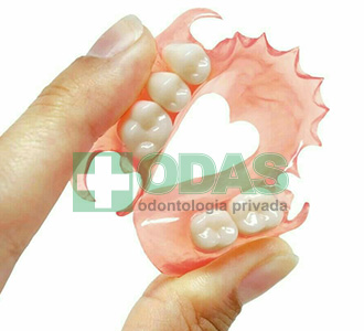 reconstruccion dental odas